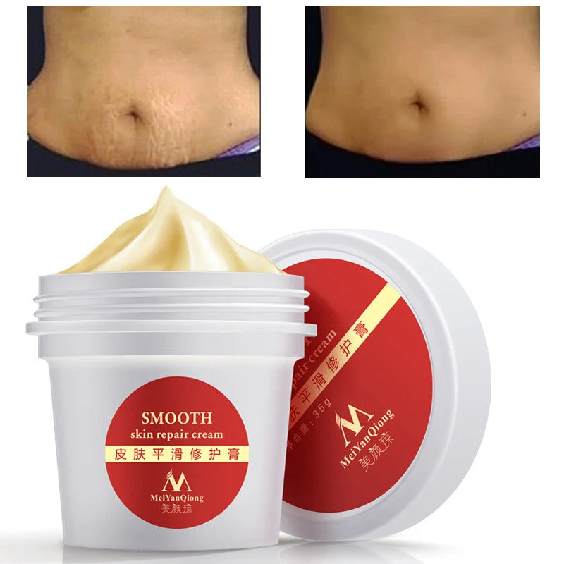 allesxl-12937843